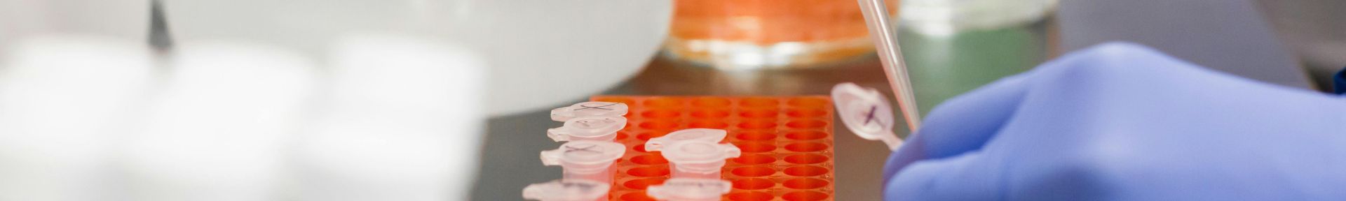 Close-up of a scientist using pipette in laboratory with test tubes.
